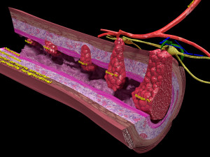 3D Colon cancer staging detail labelled 3D Model
