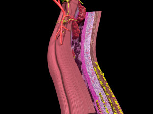 3D Colon cancer staging detail labelled 3D Model