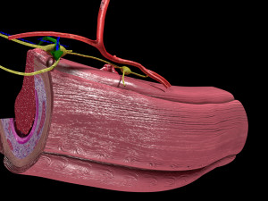 3D Colon cancer staging detail labelled 3D Model