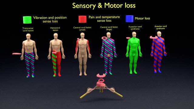 Spinal cord injuries and its various sensory and motor signs 3D Модель .c4d .max .obj .3ds .fbx .stl .blend 