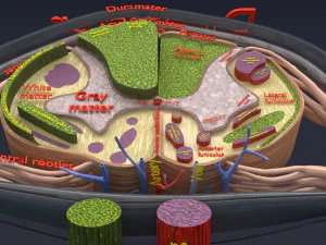 Spinal cord injuries and its various sensory and motor signs 3D Model