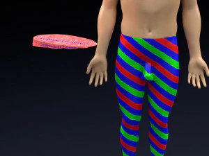 Spinal cord injuries and its various sensory and motor signs 3D Model