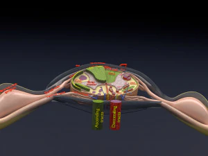 Spinal cord injuries and its various sensory and motor signs 3D Model