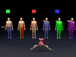 Spinal cord injuries and its various sensory and motor signs 3D Model