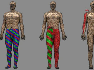 Spinal cord injuries and its various sensory and motor signs 3D Model