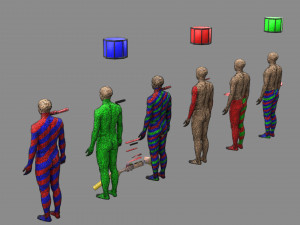 Spinal cord injuries and its various sensory and motor signs 3D Модель