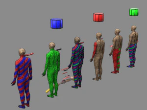 Spinal cord injuries and its various sensory and motor signs 3D Model