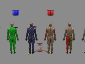 Spinal cord injuries and its various sensory and motor signs 3D Model