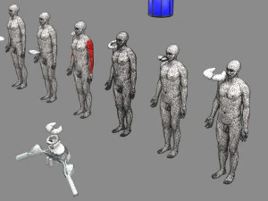 Spinal cord injuries and its various sensory and motor signs 3D Model