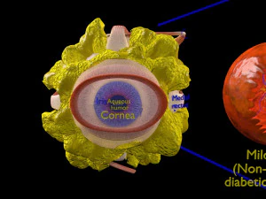 Diabetic eye diseases model 3D Model