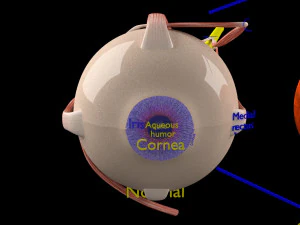 Diabetic eye diseases model 3D Model