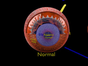 Diabetic eye diseases model 3D Model