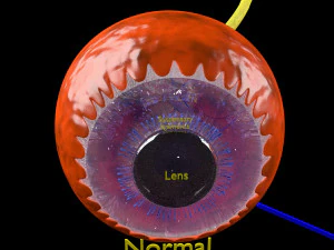 Diabetic eye diseases model 3D Model