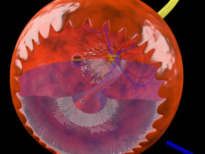 Diabetic eye diseases model 3Dモデル