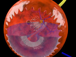 Diabetic eye diseases model 3D Model