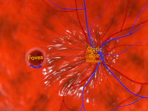 Diabetic eye diseases model 3D Model