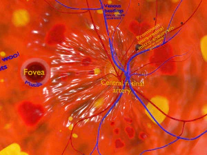 Diabetic eye diseases model 3D Model