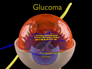 Diabetic eye diseases model 3D Model