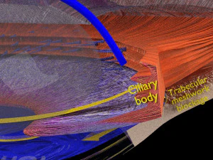 Diabetic eye diseases model 3D Model
