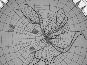 Diabetic eye diseases model 3Dモデル