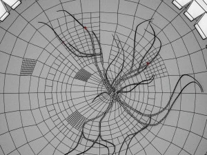 Diabetic eye diseases model 3D Model