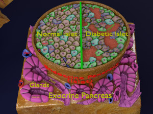 Diabetes pancreas anatomy microscopy islet beta insulin model Modelo 3D