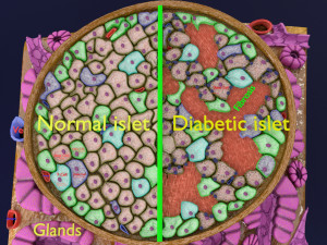 Diabetes pancreas anatomy microscopy islet beta insulin model Modelo 3D