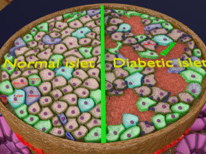 Diabetes pancreas anatomy microscopy islet beta insulin model Modelo 3D
