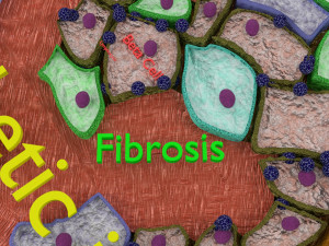 Diabetes pancreas anatomy microscopy islet beta insulin model Modelo 3D