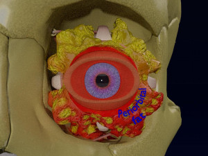 Eye blow out injury 3d 3D Модель
