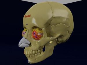 Eye blow out injury 3d 3D Модель