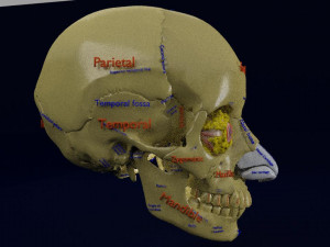 Eye blow out injury 3d 3D Модель