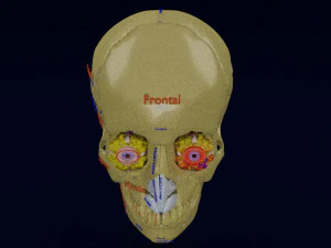 Eye blow out injury 3d 3D Model