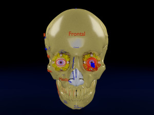 Eye blow out injury 3d 3D Модель