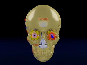 Eye blow out injury 3d 3D Model
