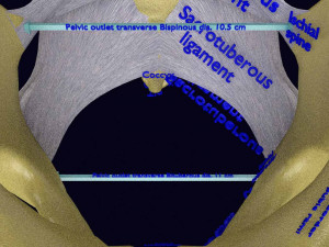 Female pelvis dimensions pelvimetry 3D-Modell