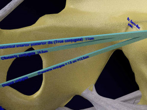 Female pelvis dimensions pelvimetry 3D-Modell
