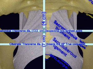 Female pelvis dimensions pelvimetry 3D-Modell