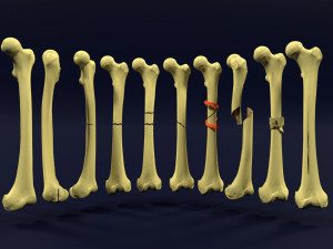 Fracture types labelled Model 3D