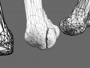 Fracture types labelled 3D Model