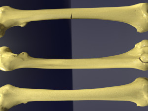 Fracture types labelled Model 3D