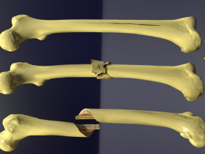 Fracture types labelled Model 3D