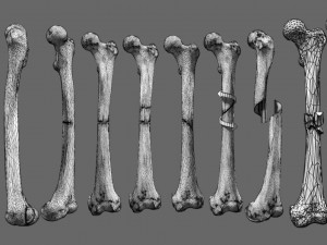 Fracture types labelled Model 3D