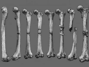 Fracture types labelled 3D Model