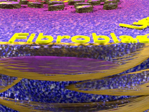 3D Caseating granuolma tuberculosis labelled model 3D Model