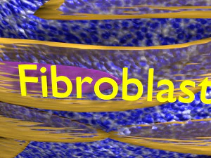 3D Caseating granuolma tuberculosis labelled model 3D Model