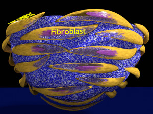 3D Caseating granuolma tuberculosis labelled model Modelo 3D