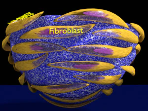 3D Caseating granuolma tuberculosis labelled model 3D Model