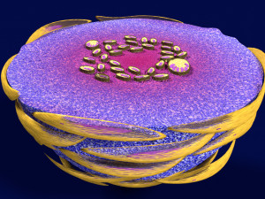 3D Caseating granuolma tuberculosis labelled model Modelo 3D