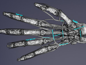 Upper limb arteries- axilla arm forearm hand 3D मॉडल